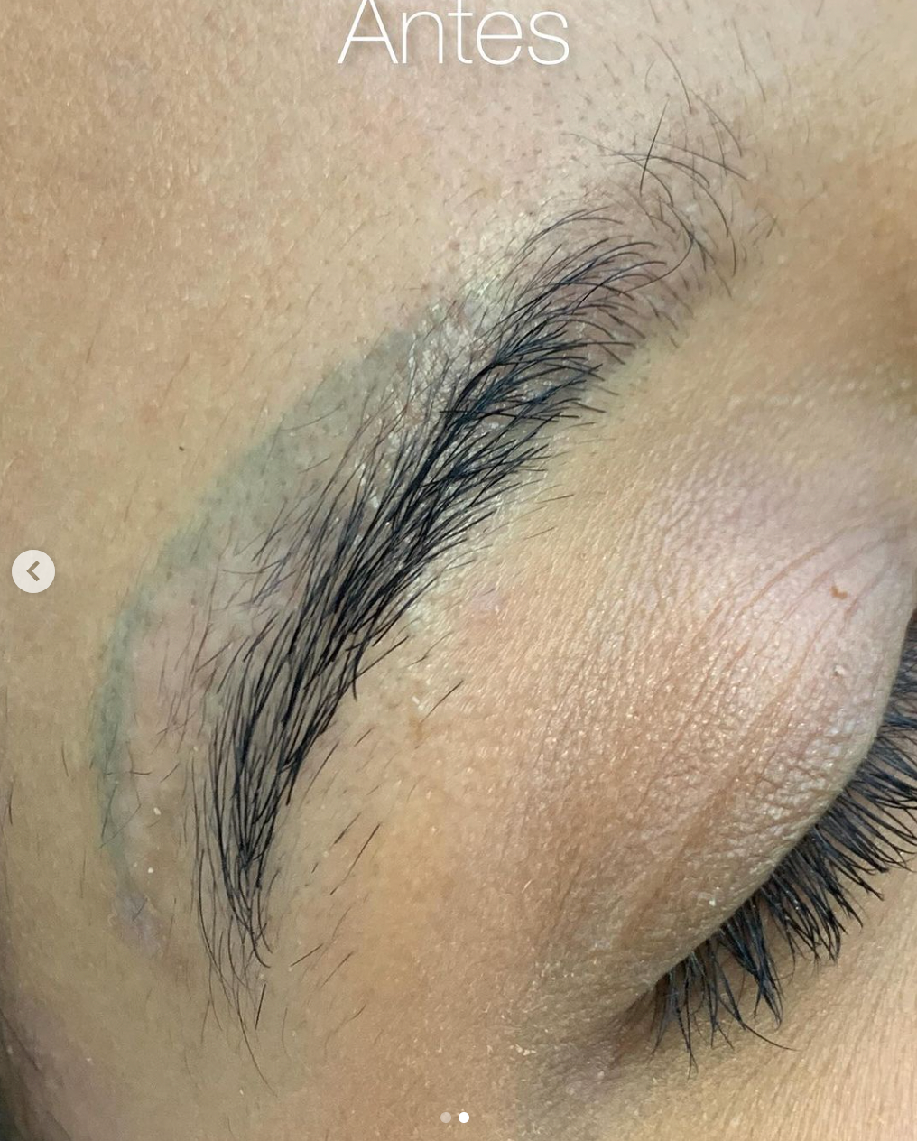 Cejas antes del proceso de remoción de micropigmentación
